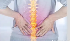 腰椎间盘突出有望算工伤